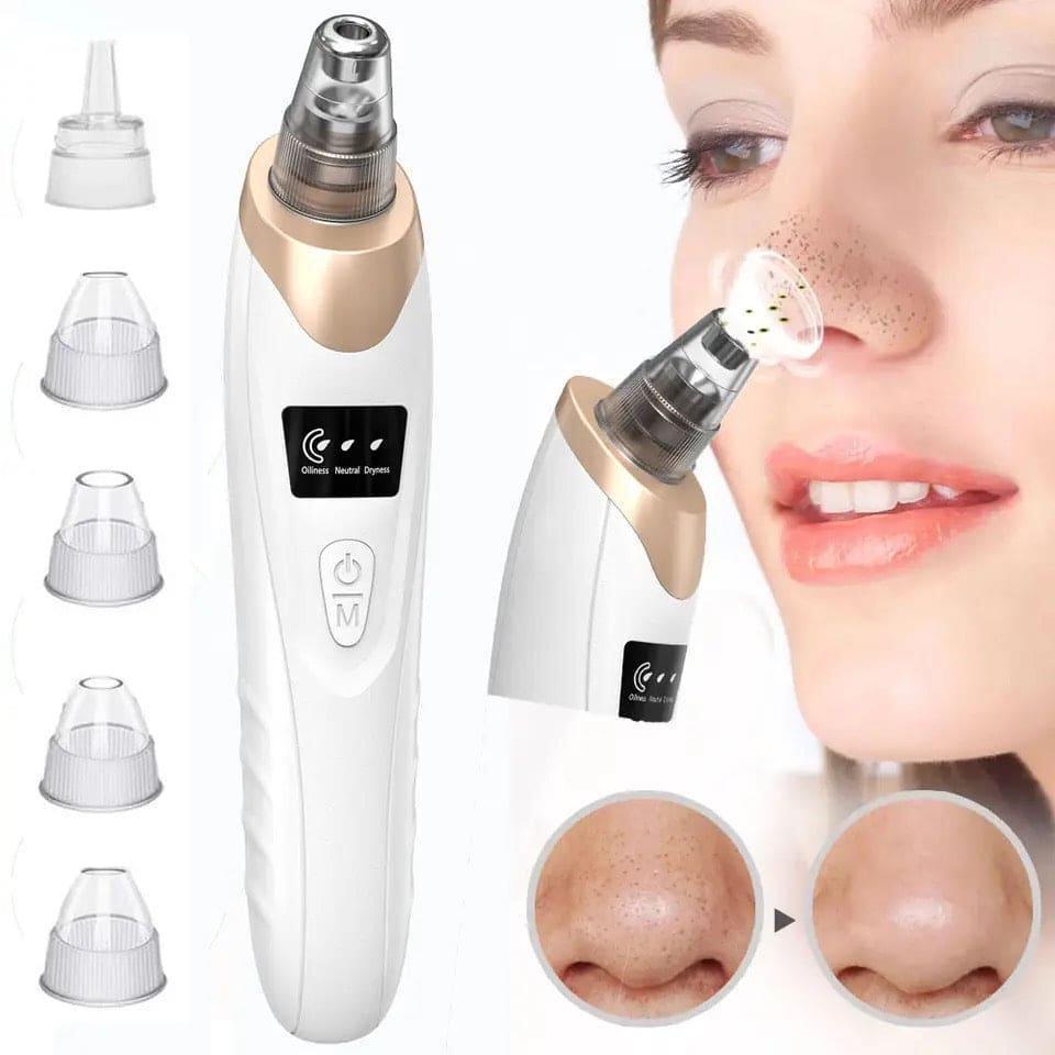 5-in-1 Blackhead Remover Machine – Rechargeable Face Vacuum Pore Cleaner